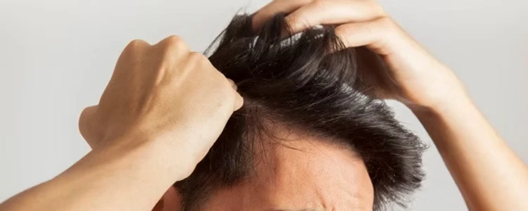 Greffe de cheveux, barbe et sourcils