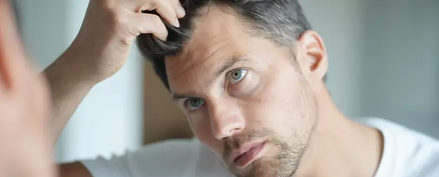 Pourquoi choisir une greffe de cheveux